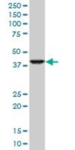 RNF2 Antibody (4A9), Novus Biologicals 0.1 mg | Buy Online | Novus Biologicals | Fisher Scientific