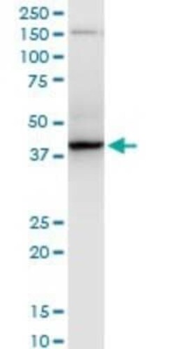 RNF2 Antibody (4A9), Novus Biologicals 0.1 mg | Buy Online | Novus Biologicals | Fisher Scientific