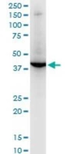 RNF2 Antibody (4A9), Novus Biologicals 0.1 mg | Buy Online | Novus Biologicals | Fisher Scientific