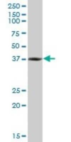 RNF2 Antibody (4A9), Novus Biologicals 0.1 mg | Buy Online | Novus Biologicals | Fisher Scientific