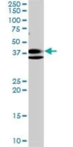 RNF2 Antibody (6C2), Novus Biologicals 0.1 mg | Buy Online | Novus Biologicals | Fisher Scientific