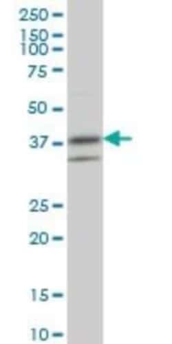 RNF2 Antibody (6C2), Novus Biologicals 0.1 mg | Buy Online | Novus Biologicals | Fisher Scientific