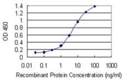 RNF212 Antibody (5H3), Novus Biologicals 0.1 mg | Buy Online | Novus Biologicals | Fisher Scientific