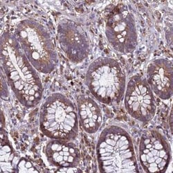 RNF215 Antibody, Novus Biologicals 25ul; Unconjugated:Antibodies, Polyclonal