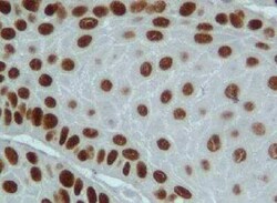 RNF25 Antibody (1D10), Novus Biologicals 0.1 mg | Buy Online | Novus Biologicals | Fisher Scientific