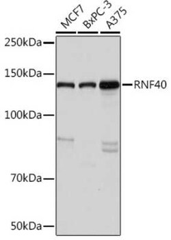 RNF40 Rabbit anti-Human, Mouse, Clone: 8I7R5, Novus Biologicals 100 &mu;g | Buy Online | Novus Biologicals | Fisher Scientific