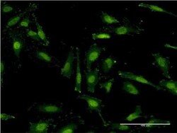 Novus Biologicals RNF40 Antibody (1C1), Novus Biologicals 0.1 mg | Buy Online | Novus Biologicals&trade; | Fisher Scientific