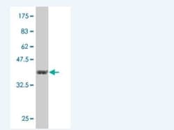 RNF70 Antibody (3E10), Novus Biologicals 0.1 mg; Unconjugated:Antibodies,