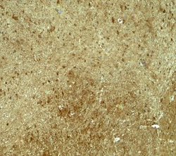 RNF70 Antibody - BSA Free, Novus Biologicals 0.1 mg; Unconjugated:Antibodies,