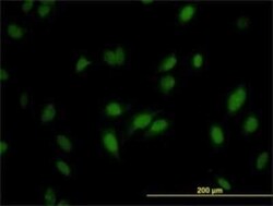 RNMT Antibody (3H3-1D12), Novus Biologicals 0.1 mg | Buy Online | Novus Biologicals | Fisher Scientific