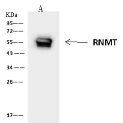 RNMT Antibody, Novus Biologicals:Antibodies:Primary Antibodies