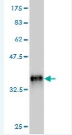 RNPS1 Antibody (2G11), Novus Biologicals 0.1 mg | Buy Online | Novus Biologicals | Fisher Scientific