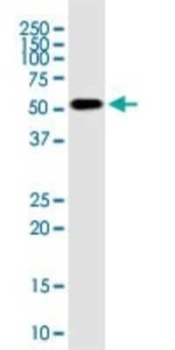 RNPS1 Antibody (7G8), Novus Biologicals 0.1 mg | Buy Online | Novus Biologicals | Fisher Scientific