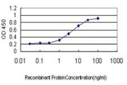 RNase H1 Antibody (5D10), Novus Biologicals 0.1 mg | Buy Online | Novus Biologicals | Fisher Scientific