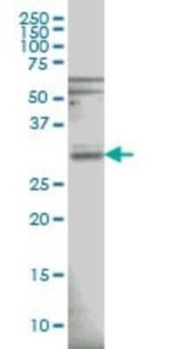 RNase H1 Antibody (5D10), Novus Biologicals 0.1 mg | Buy Online | Novus Biologicals | Fisher Scientific