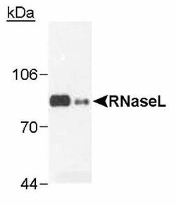 RNase L Antibody (2E9) - Azide and BSA Free, Novus Biologicals 0.1 mL | Buy Online | Novus Biologicals | Fisher Scientific