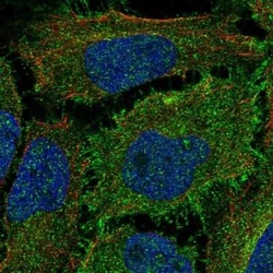 ROBO1 Antibody, Novus Biologicals 25ul; Unconjugated:Antibodies, Polyclonal