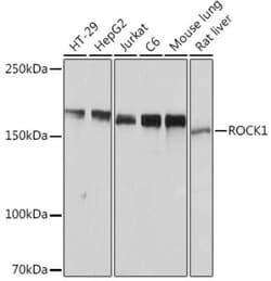 ROCK1 Rabbit anti-Human, Mouse, Rat, Clone: H5E4, Novus Biologicals:Antibodies:Primary