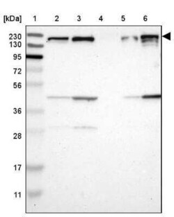 ROCK1 Antibody, Novus Biologicals 25 &mu;L | Buy Online | Novus Biologicals | Fisher Scientific