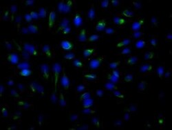 ROCK2 Antibody (10E1), Novus Biologicals 100 &mu;g | Buy Online | Novus Biologicals | Fisher Scientific