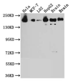 ROCK2 Antibody (10E1), Novus Biologicals 100 &mu;g | Buy Online | Novus Biologicals | Fisher Scientific
