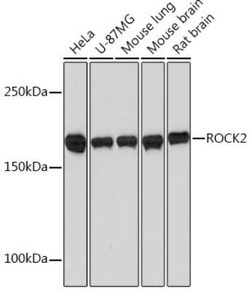 ROCK2 Rabbit anti-Human, Mouse, Rat, Clone: 8G3U2, Novus Biologicals 100 &mu;g | Buy Online | Novus Biologicals | Fisher Scientific