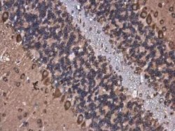 ROCK2 Antibody (GT11712), Novus Biologicals 100 &mu;g | Buy Online | Novus Biologicals | Fisher Scientific