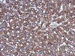 ROCK2 Antibody (GT11712), Novus Biologicals 100 &mu;g | Buy Online | Novus Biologicals | Fisher Scientific