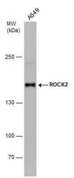 ROCK2 Antibody (GT11712), Novus Biologicals 100 &mu;g | Buy Online | Novus Biologicals | Fisher Scientific