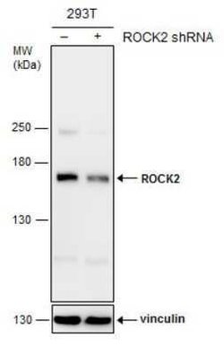 ROCK2 Antibody (GT11712), Novus Biologicals 100 &mu;g | Buy Online | Novus Biologicals | Fisher Scientific