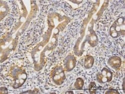 ROCK2 Antibody (1E12), Novus Biologicals 0.1 mg | Buy Online | Novus Biologicals | Fisher Scientific