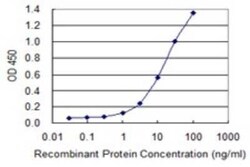 ROCK2 Antibody (1E12), Novus Biologicals 0.1 mg | Buy Online | Novus Biologicals | Fisher Scientific