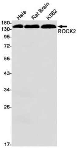 ROCK2 Antibody (S01-4F1), Novus Biologicals:Antibodies:Primary Antibodies