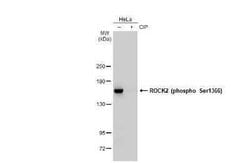 ROCK2, p Ser1366 Antibody (HL1071), Novus Biologicals 100 &mu;g | Buy Online | Novus Biologicals | Fisher Scientific