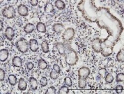 Novus Biologicals ROD1 Antibody (4C9), Novus Biologicals 0.1 mg | Buy Online | Novus Biologicals&trade; | Fisher Scientific