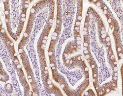 ROGDI Antibody, Novus Biologicals:Antibodies:Primary Antibodies