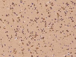 ROR beta Antibody, Novus Biologicals 50 &mu;g, Unconjugated:Antibodies,