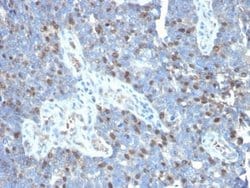 ROR gamma/RORC/NR1F3 Mouse anti-Human, Clone: RORC/2941, Novus Biologicals