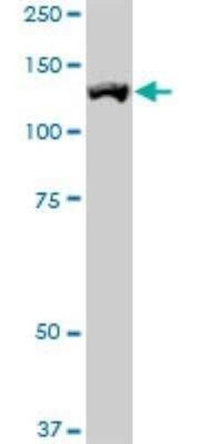 ROR1 Antibody (2F8), Novus Biologicals 0.1 mg | Buy Online | Novus Biologicals | Fisher Scientific