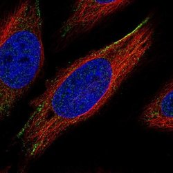 ROR2 Antibody (CL5950), Novus Biologicals 25 &mu;L:Antibodies, Monoclonal