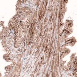 ROR2 Antibody (CL5950), Novus Biologicals 25 &mu;L:Antibodies, Monoclonal