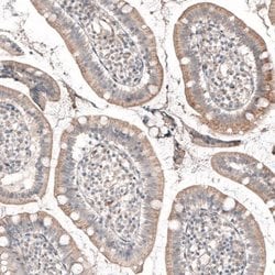ROR2 Antibody (CL5950), Novus Biologicals 25 &mu;L:Antibodies, Monoclonal
