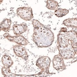 ROR2 Antibody (CL5950), Novus Biologicals 25 &mu;L:Antibodies, Monoclonal