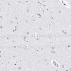 RP105/CD180 Antibody, Novus Biologicals 0.1 mL; Unconjugated:Antibodies,