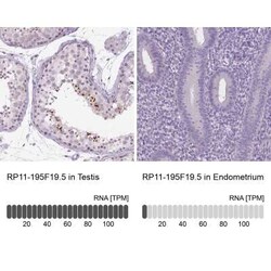 RP11-195F19.5 Antibody, Novus Biologicals:Antibodies:Primary Antibodies