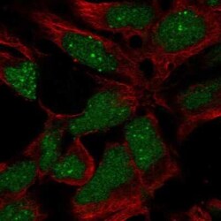 RP11-302B13.5 Antibody, Novus Biologicals 25ul; Unconjugated:Antibodies,