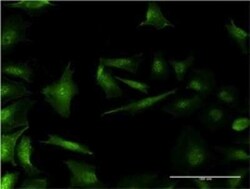 RP2 Antibody (1B4), Novus Biologicals 0.1 mg | Buy Online | Novus Biologicals | Fisher Scientific