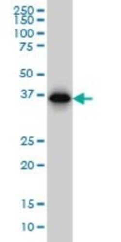 RP2 Antibody (5C10), Novus Biologicals 0.1 mg | Buy Online | Novus Biologicals | Fisher Scientific