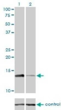RPA14 Antibody (1F4), Novus Biologicals 0.1 mg | Buy Online | Novus Biologicals | Fisher Scientific