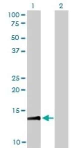 RPA14 Antibody (1F4), Novus Biologicals 0.1 mg | Buy Online | Novus Biologicals | Fisher Scientific